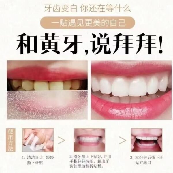 Angie·Pearla美白牙貼有效去黃提亮牙齒潔白炫白清潔牙垢黃牙煙漬茶漬潔白牙貼 - 图片 3