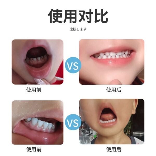 Angie.潔牙擦潔牙器工具去漬好物專用魔力擦牙齒清潔擦清潔口腔家用 - 图片 5